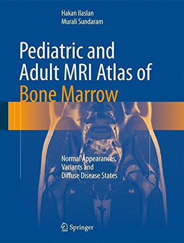 Pediatric and Adult MRI Atlas of Bone Marrow Normal Appearances, Variants and Diffuse Disease States