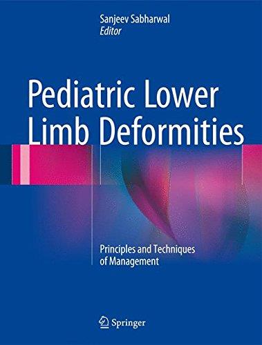 Pediatric Lower Limb Deformities Principles and Techniques of Management